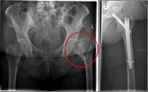 Oberschenkel 5 Oberschenkel 5